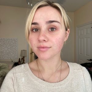 Meet your Posher, Darby